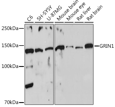 Anti-GRIN1 Antibody (CAB7677)