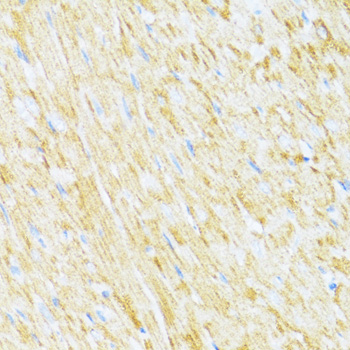 Anti-UQCR10 Antibody (CAB12587)