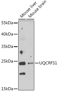 Anti-UQCRFS1 Antibody (CAB14069)