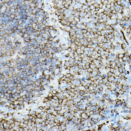 Anti-PRKCB Antibody (CAB13628)