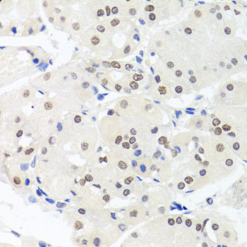 Anti-HMGN1 Antibody (CAB6155)