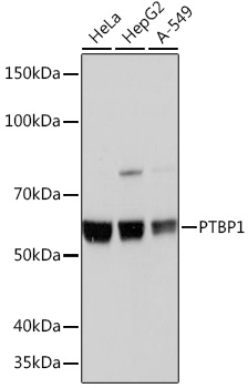 Anti-PTBP1 Antibody (CAB3487)