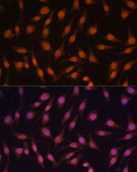 Anti-EED Antibody (CAB12773)