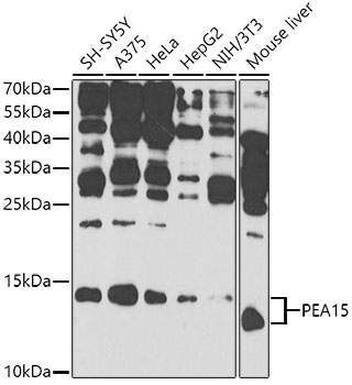 Anti-PEA15 Polyclonal Antibody (CAB9956)