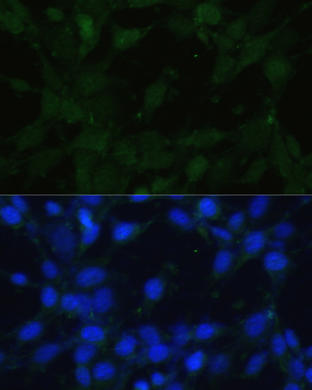 Anti-TRPV1 Polyclonal Antibody (CAB8564)