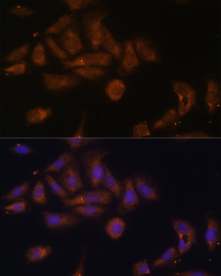 Anti-RPL7A Antibody (CAB14060)