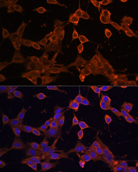 Anti-SQSTM1 Antibody (CAB11246)