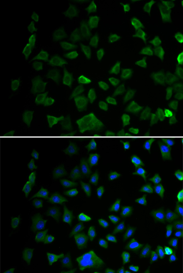 Anti-MAP2K1 Antibody (CAB0252)