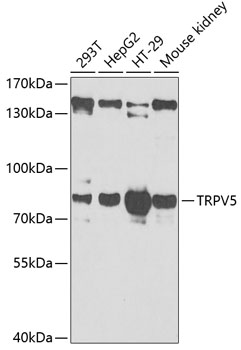 Anti-TRPV5 Antibody (CAB6473)