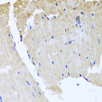 Anti-RAB24 Polyclonal Antibody (CAB8394)