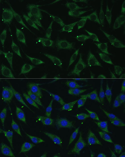 Anti-DICER1 Antibody (CAB6021)