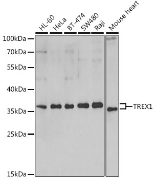 Anti-TREX1 Antibody (CAB6778)