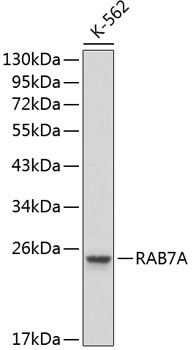 Anti-RAB7A Antibody (CAB1154)