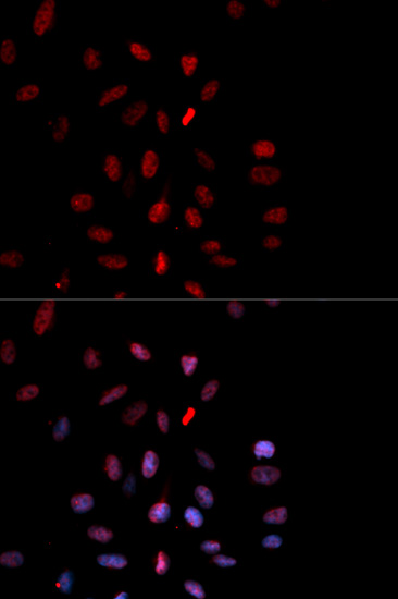 Anti-Phospho-FOS-T232 Antibody (CABP0038)