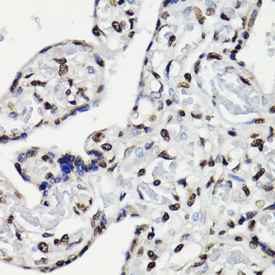 Anti-Phospho-STAT5-Y694 pAb (CABP0887)