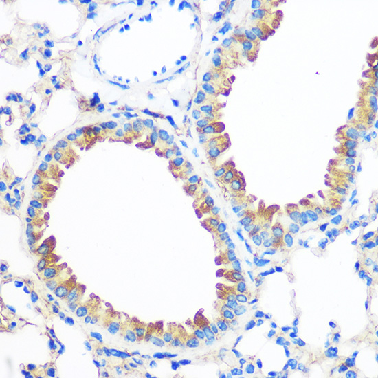 Anti-AGR2 Antibody (CAB7064)