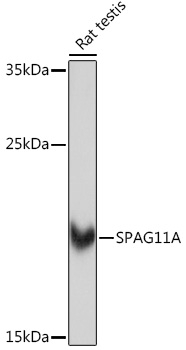 Anti-SPAG11A Antibody (CAB18673)