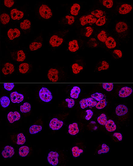 Anti-WT1 Antibody (CAB16298)