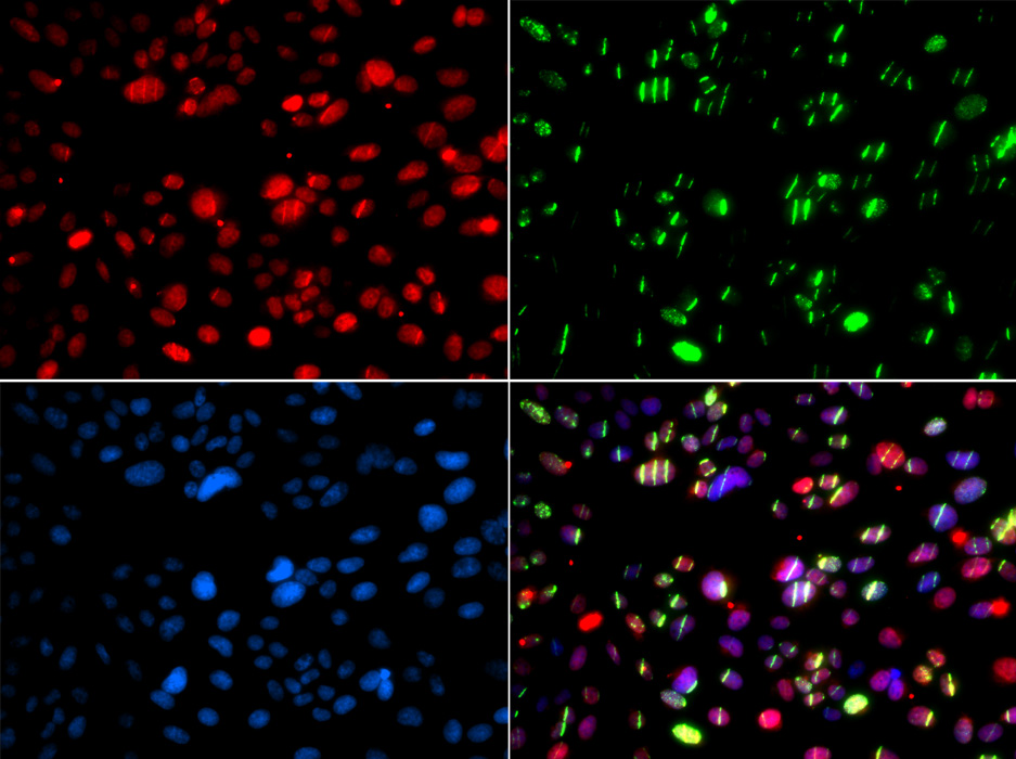 Anti-PNKP Antibody (CAB6693)