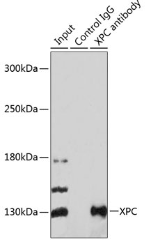 Anti-XPC Polyclonal Antibody (CAB8354)