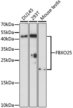 Anti-FBXO25 Antibody (CAB15150)