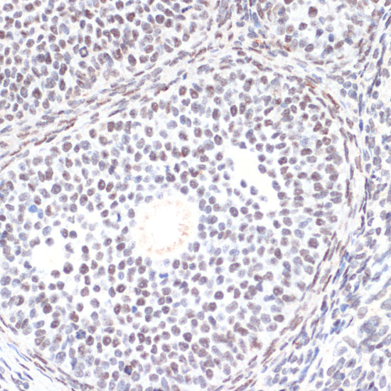 Anti-Phospho-AKT1-S473 Antibody (CABP0140)