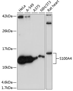 Anti-S100A4 Antibody (CAB19109)