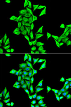 Anti-Alpha-Tubulin Antibody (CABC014)