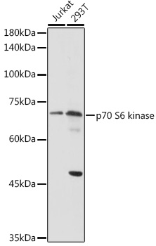 Anti-p70 S6 kinase Antibody (CAB2190)