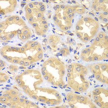 Anti-ELMO3 Antibody (CAB7182)