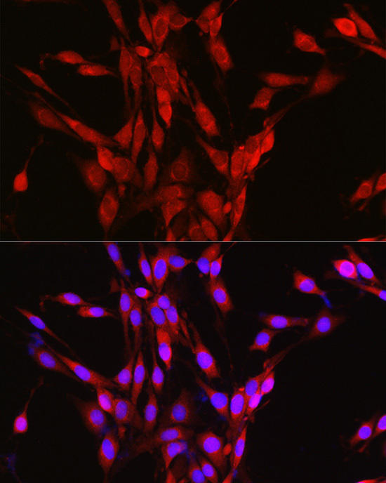 Immunofluorescence analysis of PC-12 cells using CASTOR1 Rabbit pAb at dilution of 1:50 (40x lens). Blue: DAPI for nuclear staining.