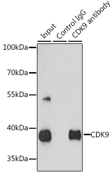 Anti-CDK9 Antibody (CAB1564)