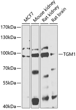 Anti-TGM1 Antibody (CAB13359)