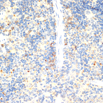 Anti-FOXP3 Antibody (CAB12051)