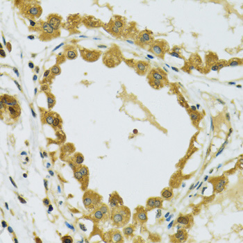 Anti-RPS7 Antibody (CAB6731)