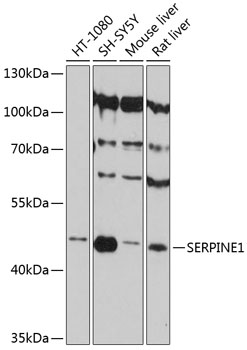 Anti-SERPINE1 Antibody (CAB12102)