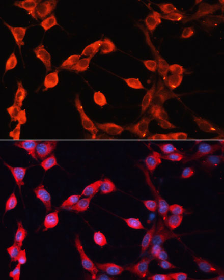 Anti-ADAMTS13 Polyclonal Antibody (CAB8482)