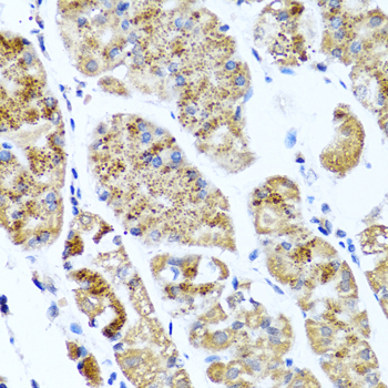 Anti-COL10A1 Antibody (CAB6889)