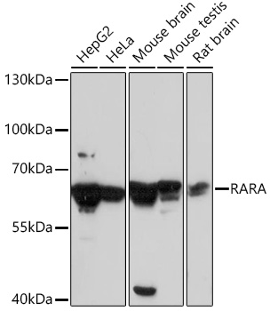 Anti-RARA Antibody (CAB7420)