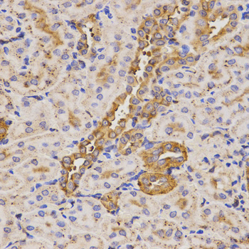 Anti-KLK5 Antibody (CAB2991)