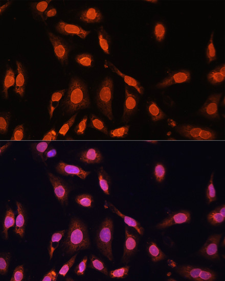 Anti-Lamin B1 Antibody (CAB16909)