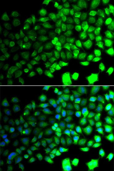 Anti-AMPKAlpha2 Antibody (CAB14052)