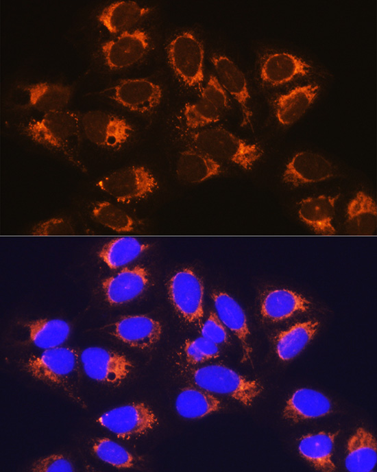 Anti-RCN1 Antibody (CAB10572)