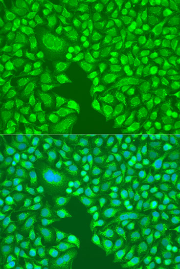 Anti-ITGA6 Antibody (CAB3236)