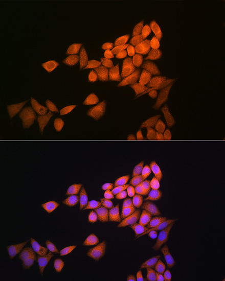 Anti-TXN Antibody (CAB0053)