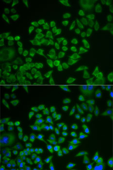 Anti-ST14 Antibody (CAB13549)