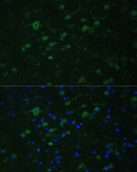 Anti-KMT2E Antibody (CAB6142)