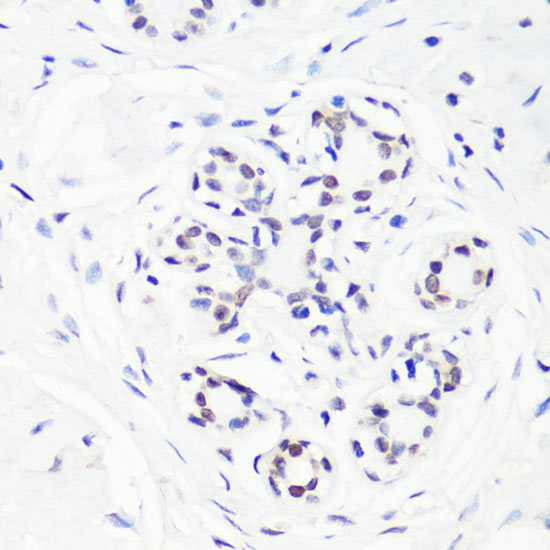 Anti-MonoMethyl-Histone H3-R17 Antibody (CAB3151)