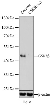 Anti-GSK3Beta Antibody [KO Validated] (CAB3174)