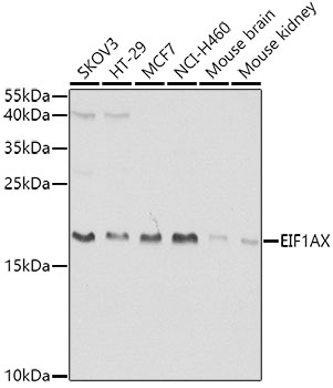 Anti-EIF1AX Antibody (CAB5917)